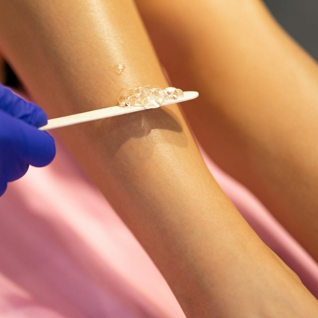 Beautician applies laser depilation gel to the patient's legs